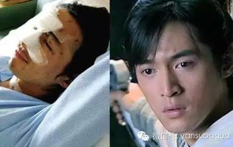 胡歌受伤前后照片